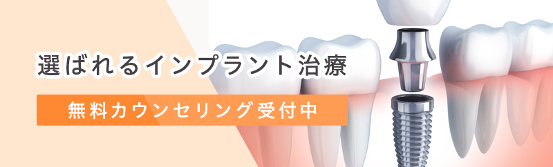 インプラント