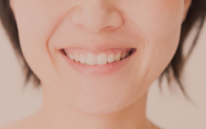 歯茎のメラニン色素除去
